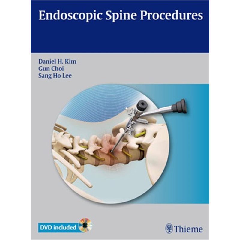 Endoscopic Spine Procedures
